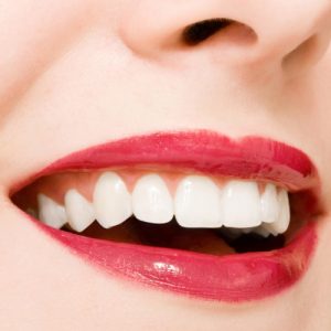 Chăm sóc răng miệng khi bọc răng sứ 2