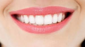 Như thế nào là tẩy trắng răng an toàn?