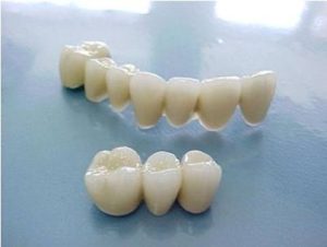 Cách khắc phục khi răng bị mòn mặt nhai 2