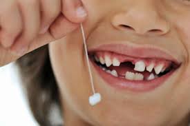 Những trường hợp nên cấy ghép implant răng hàm 1