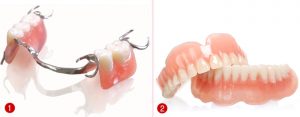 Nên chọn loại răng giả nào? 2 Nên chọn loại răng giả nào? 2