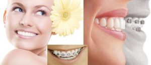Công nghệ 3D trong dịch vụ niềng răng 2
