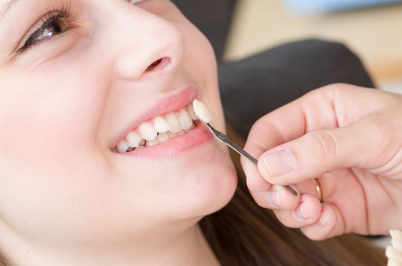 Bọc răng sứ cho răng khấp khểnh 2