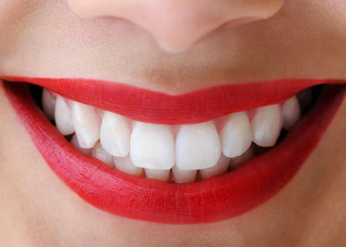 Cắm implant răng cửa như thế nào? 2