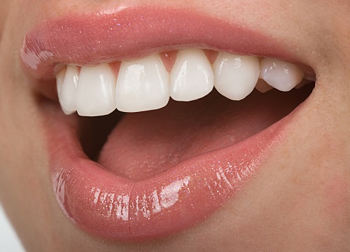 Cao răng nhiều lấy cao răng có đau hay không? 3