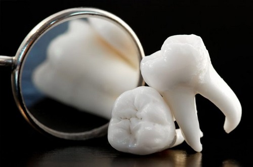 Nhổ răng hàm có ảnh hưởng gì không? 3