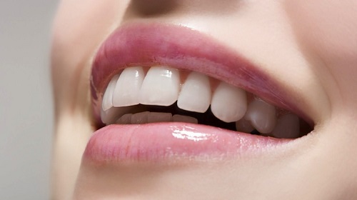 Có nên làm răng sứ hay không? Một số review khách hàng đã làm răng sứ