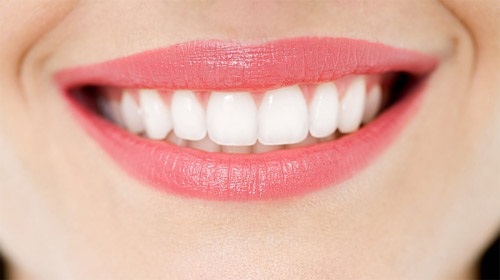 Một số lý do chính dẫn đến răng sứ bị đen viền nướu bạn nên biết-3