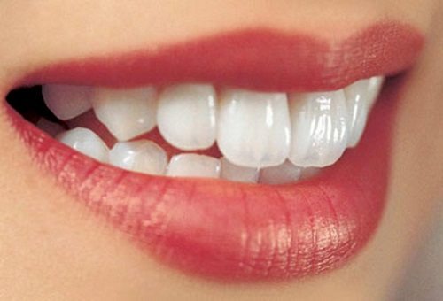 Trám răng mất thời gian bao lâu là hoàn thành? 3