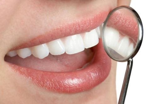 Trám răng thẩm mỹ là gì? Ưu và nhược điểm của phương pháp này 3