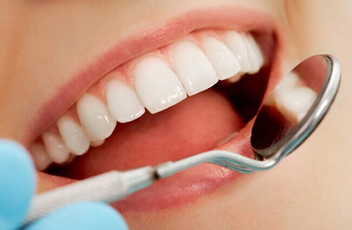 Bọc răng sứ titan có tốt không? Thông tin cần biết về răng sứ titan