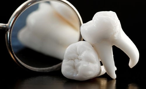 Bọc răng sứ cho răng hàm sâu có được không?
