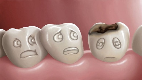 Tư vấn từ nha khoa - Bọc răng sứ có thay được không?