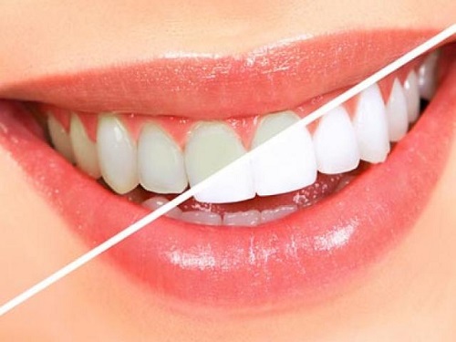 Lưu ý khi sử dụng bột tẩy trắng răng eucryl