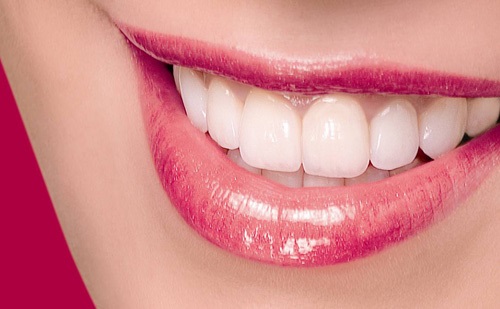 Làm răng sứ có đau không? Cần lưu ý gì khi làm răng sứ