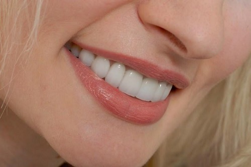 Hiện nay làm răng sứ thẩm mỹ loại nào tốt nhất?