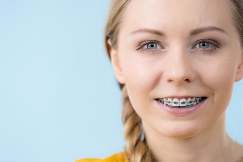 Phương pháp niềng răng làm răng lung lay có sao không
