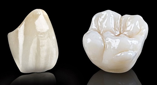 Tìm hiểu thông tin về răng sứ Ceramill