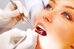 Răng sứ có đính đá được không? Thực hiện như thế nào