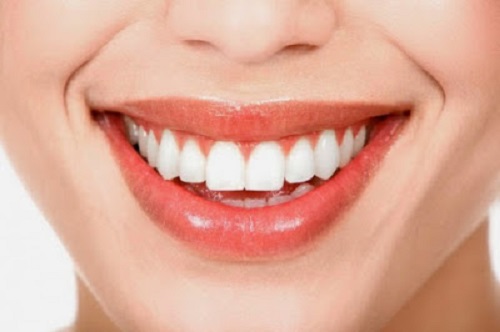 Răng sứ có tháo ra được không? Chia sẻ từ khách hàng và tư vấn nha khoa