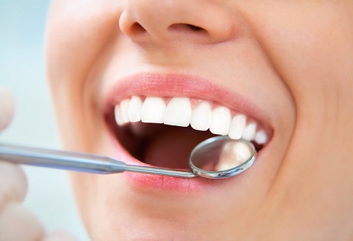 Trồng răng sứ dùng được bao lâu? Có đạt kết quả lâu dài không