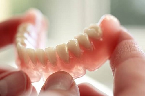 Trồng răng sứ mất thời gian bao lâu? Cách thực hiện
