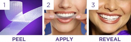 Miếng dán tẩy trắng răng và những lợi ích bạn cần biết 3