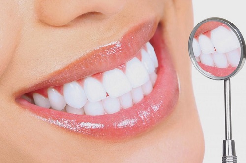 Miếng dán tẩy trắng răng và những lợi ích bạn cần biết 4