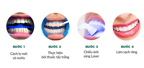  Tẩy trắng răng brite smile - Công nghệ mới 2