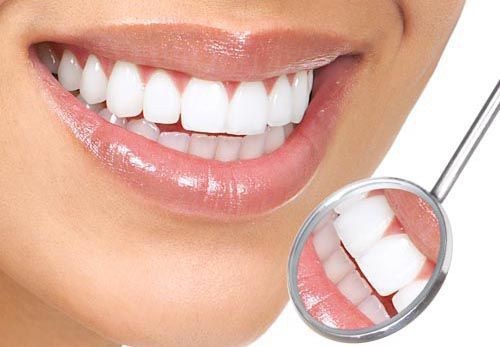  Tẩy trắng răng brite smile - Công nghệ mới 3