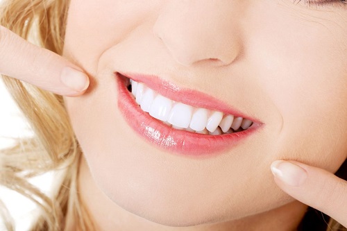 Có nên tẩy trắng răng nhiều lần không? Vì sao 1