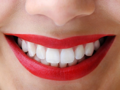 Có nên tẩy trắng răng nhiều lần không? Vì sao 3