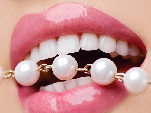 Tẩy trắng răng có ảnh hưởng gì không? Cần lưu ý điều gì? 2 Tẩy trắng răng có ảnh hưởng gì không? Cần lưu ý điều gì? 2
