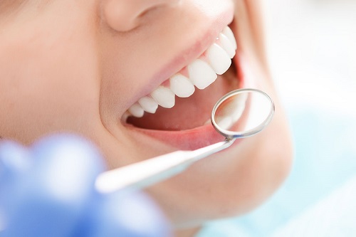 Tẩy trắng răng có ảnh hưởng gì không? Cần lưu ý điều gì? 3