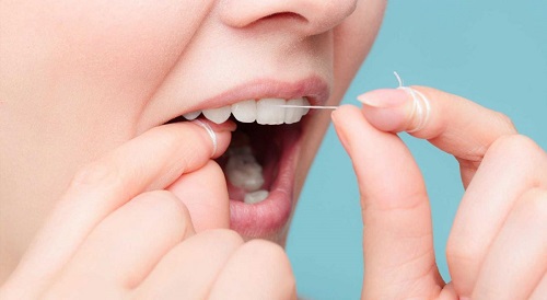 Răng khôn hàm trên bị vỡ - Liệu có nên nhổ? 3