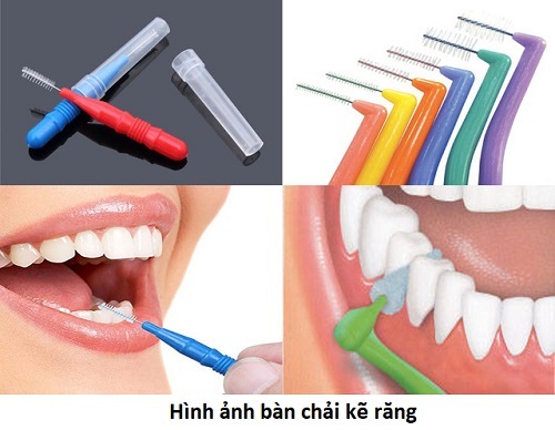 Niềng răng nên dùng bàn chải gì? Tham khảo từ nha khoa 2