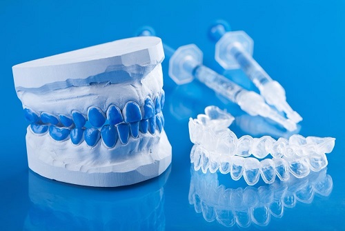 Tẩy trắng răng bằng máng bao nhiêu tiền? Chi phí mới nhất 2 Tẩy trắng răng bằng máng bao nhiêu tiền? Chi phí mới nhất 2