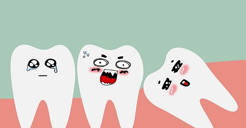 Răng khôn không đau có cần nhổ không? Tham khảo thông tin 1