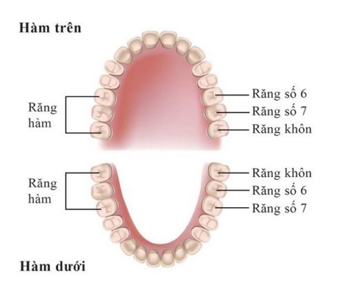 Trồng răng giả hàm dưới cần lưu ý điều gì? 1