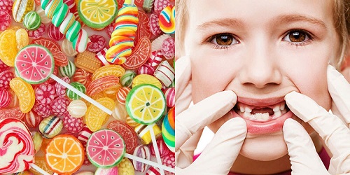 Thực phẩm gây sâu răng ở trẻ em cần phòng tránh 2