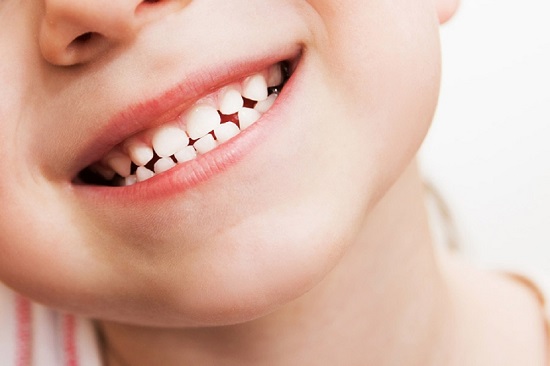 Nhổ răng sữa cho trẻ em nhẹ nhàng và không đau 3